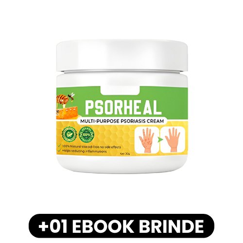 PsorHeal - Creme Multiuso para Psoríase - Mania das CoisasPsorHeal - Creme Multiuso para PsoríaseMania das Coisas