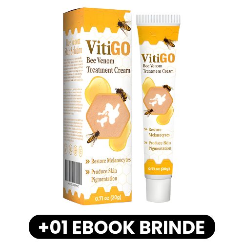 VitiGO - Creme de Tratamento para Vitiligo - Mania das CoisasVitiGO - Creme de Tratamento para VitiligoMania das Coisas